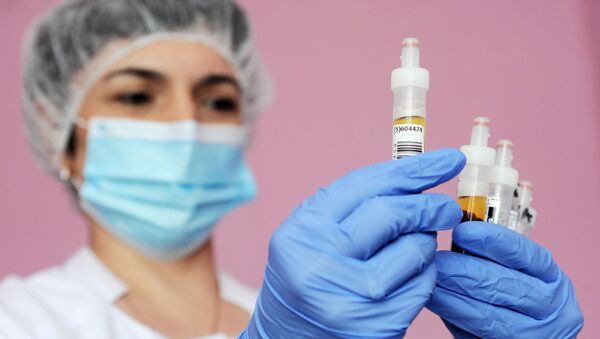 Лаборант держит в руках образцы крови - 俄羅斯衛星通訊社