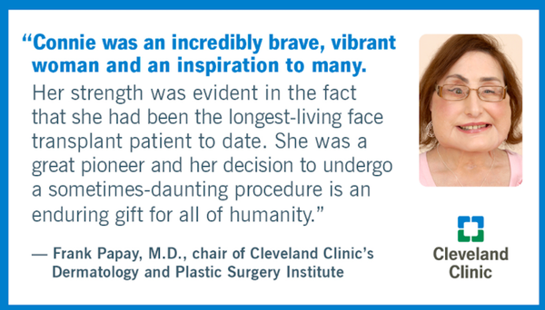 美国首例接受面部移植手术的女子去世 (图片) 美国首例接受面部移植手术的女子去世 (图片) - 俄罗斯卫星通讯社