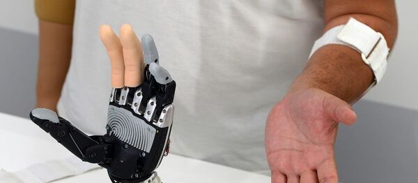 Бионический протез - 俄罗斯卫星通讯社