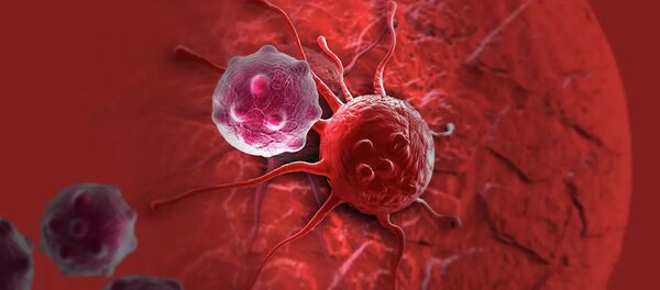 俄科学家找到通过呼气检测呼吸道癌症的方法 - 俄罗斯卫星通讯社