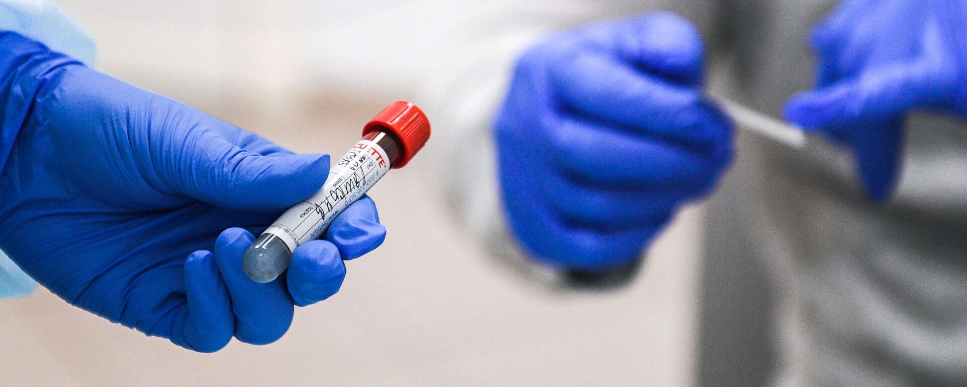 Пробирка с кровью пациента, сдавшего тест на наличие антител к вирусу SARS-CoV-2 - 俄罗斯卫星通讯社, 1920, 22.12.2021