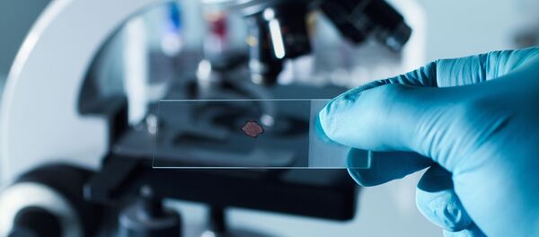 Тест-образец на предметном столе микроскопа  - 俄罗斯卫星通讯社