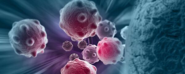 Раковая клетка в теле человека - 俄罗斯卫星通讯社