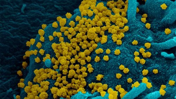 Изображение SARS-CoV-2, полученное с помощью сканирующей электронной микроскопии мазка из носоглотки пациентки с ослабленным иммунитетом - 俄罗斯卫星通讯社