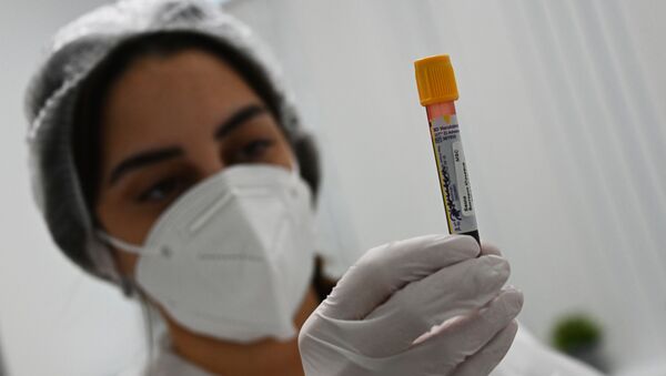 Пробирка с кровью в лаборатории Гемотест в Москве для тестирования эффективности вакцины от коронавируса COVID-19 Спутник V - 俄羅斯衛星通訊社