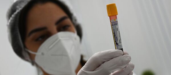 Пробирка с кровью в лаборатории Гемотест в Москве для тестирования эффективности вакцины от коронавируса COVID-19 Спутник V - 俄羅斯衛星通訊社