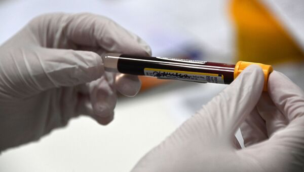 Пробирка с кровью в лаборатории Гемотест в Москве для тестирования эффективности вакцины от коронавируса COVID-19 Спутник V - 俄罗斯卫星通讯社
