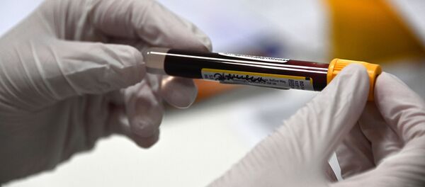 Пробирка с кровью в лаборатории Гемотест в Москве для тестирования эффективности вакцины от коронавируса COVID-19 Спутник V - 俄羅斯衛星通訊社