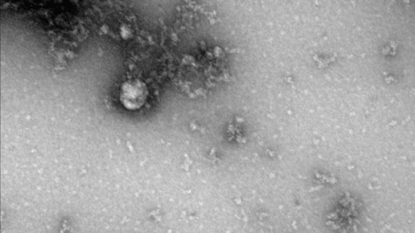 报告：《柳叶刀》杂志不排除新冠病毒来自实验室 - 俄罗斯卫星通讯社