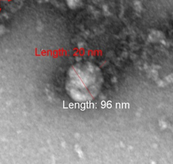 俄科学家拍摄到英国新冠毒株首张照片 - 俄罗斯卫星通讯社