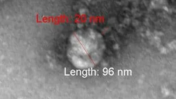 Снимок британского штамма нового коронавируса - 俄羅斯衛星通訊社