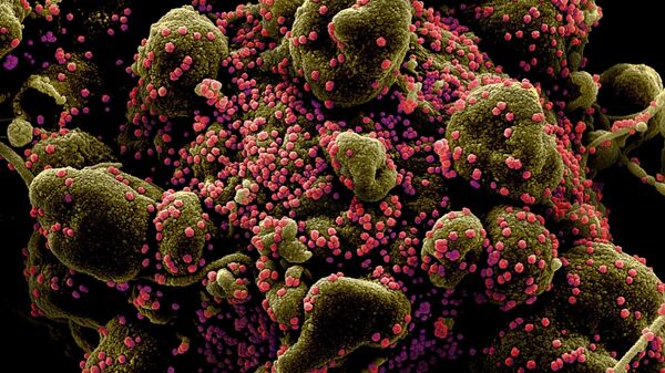 Вид на зараженную коронавирусом клетку под микроскопом - 俄羅斯衛星通訊社
