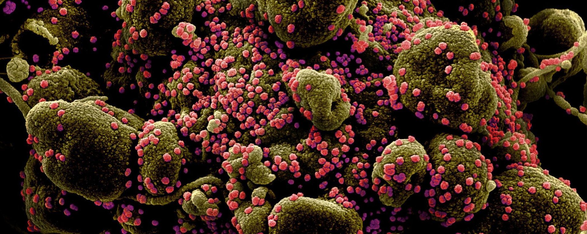 Вид на зараженную коронавирусом клетку под микроскопом - 俄罗斯卫星通讯社, 1920, 29.03.2021