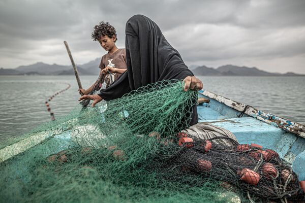 也门照片：阿根廷摄影师巴勃罗•托斯科的《饥饿，另一个战争创伤》，获得当代热点类第一名。 - 俄罗斯卫星通讯社