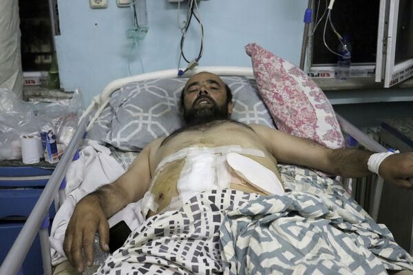 阿富汗，喀布尔恐怖袭击后，接受过治疗躺在病房里的伤者。 - 俄罗斯卫星通讯社