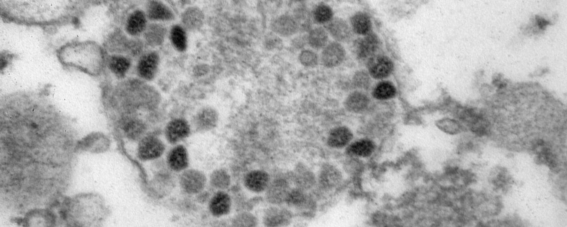 Фото вирусных частиц COVID-19 штамма омикрон - 俄羅斯衛星通訊社, 1920, 26.12.2021