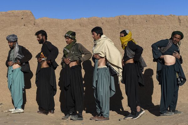 阿富汗男子們展示賣腎後的傷疤。 - 俄羅斯衛星通訊社