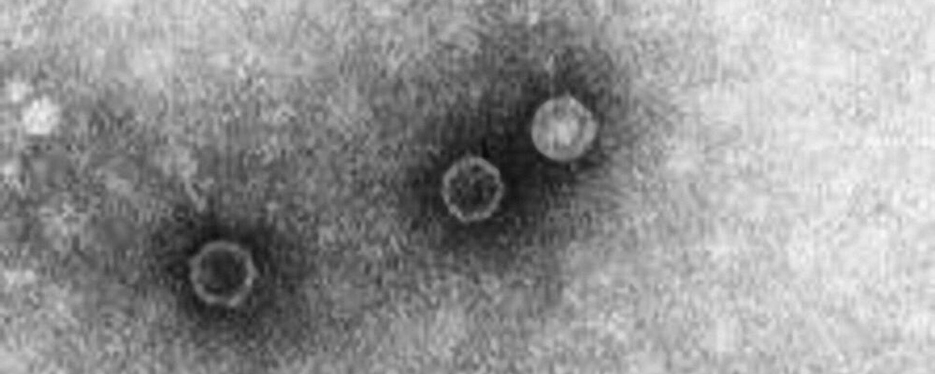 脊髓灰質炎病毒 - 俄羅斯衛星通訊社, 1920, 12.08.2022