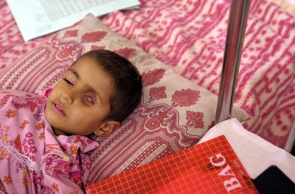 2001年1月15日，在距伊拉克南部城鎮巴士拉約60公里的加茲萬兒童醫院，患有眼部腫瘤的4歲女孩阿拉·薩利姆躺在床上等待藥物治療。伊拉克方面稱，海灣戰爭期間，該地區被投放了300噸貧鈾彈，是當地癌症病例增加的原因。  - 俄羅斯衛星通訊社