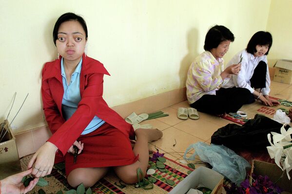 越南橙劑受害者與其同學 - 俄羅斯衛星通訊社