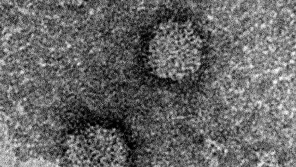 荊門病毒 - 俄羅斯衛星通訊社