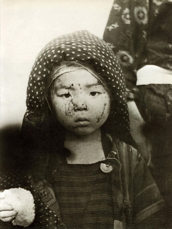 1945年8月9日長崎原子彈爆炸的受害者。 - 俄羅斯衛星通訊社