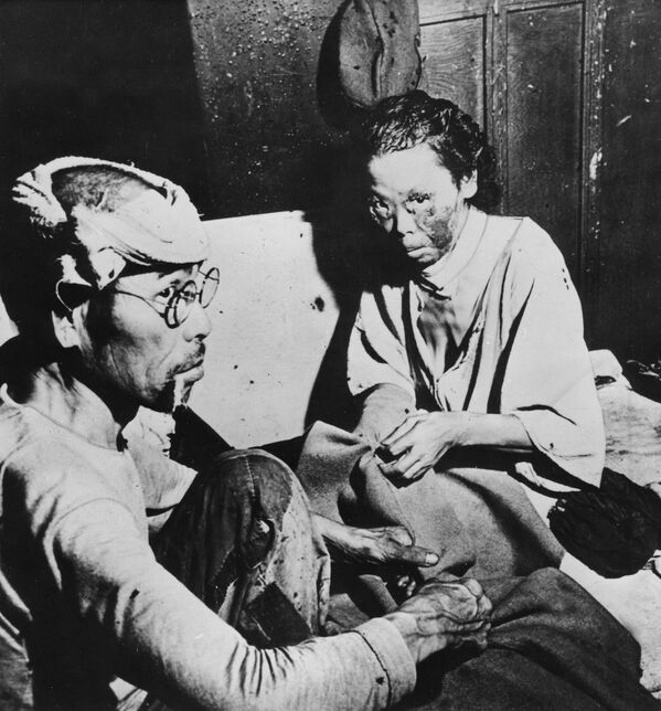 廣島原子彈爆炸的受害者。 - 俄羅斯衛星通訊社