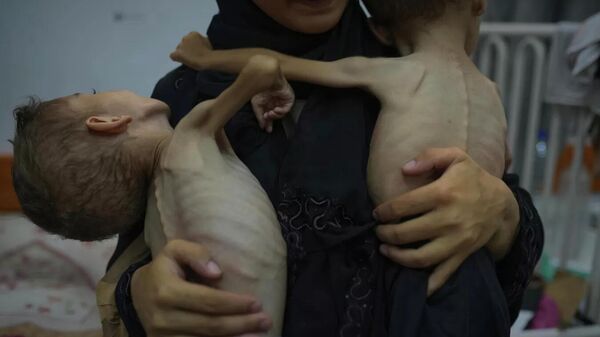 联合国：加沙地带近9.5万儿童严重营养不良 - 俄罗斯卫星通讯社