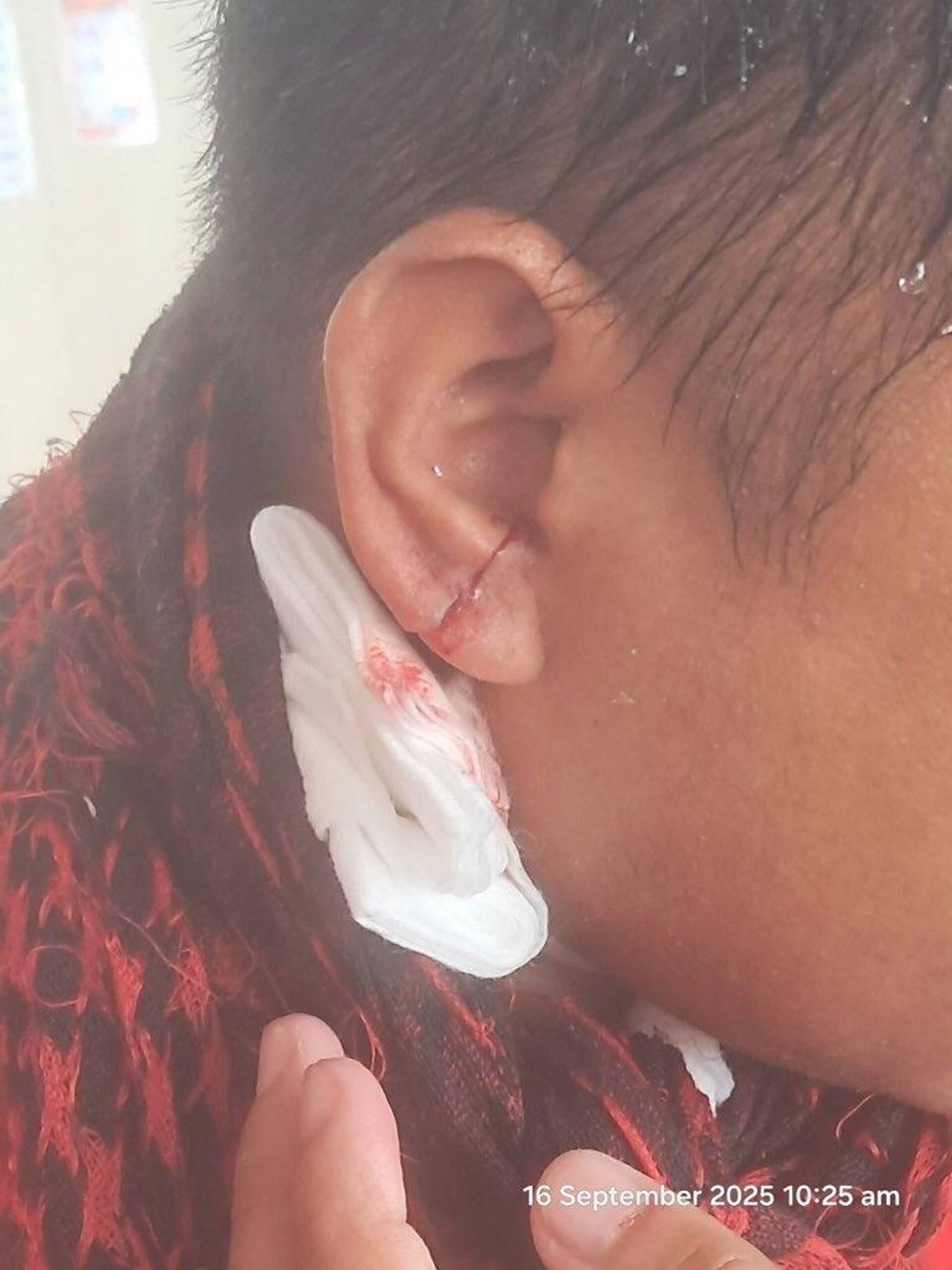 菲律賓農業部漁業和水產資源局的一名工作人員因水炮擊碎玻璃而受傷 - 俄羅斯衛星通訊社, 1920, 17.09.2025