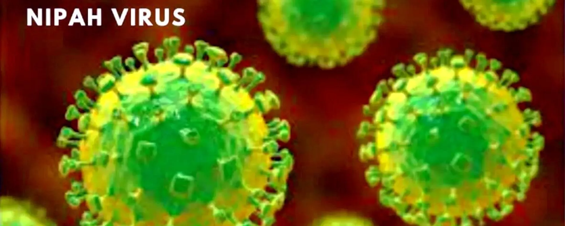 尼帕病毒 - 俄罗斯卫星通讯社, 1920, 27.01.2026