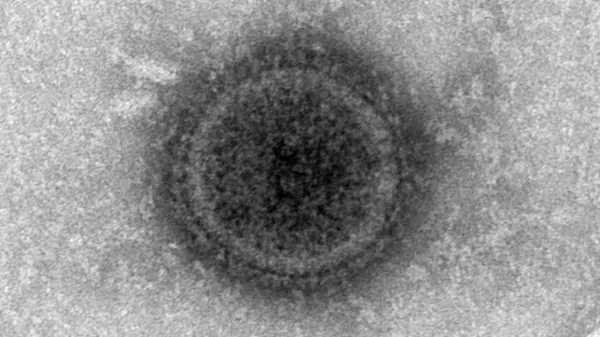 尼帕病毒 - 俄罗斯卫星通讯社