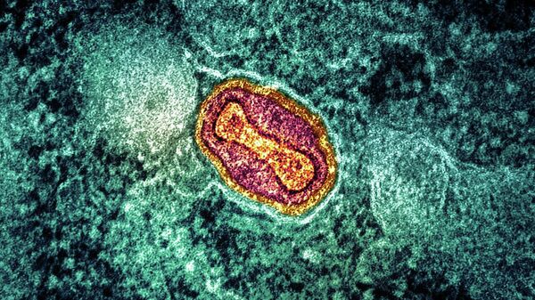 猴痘病毒 - 俄羅斯衛星通訊社