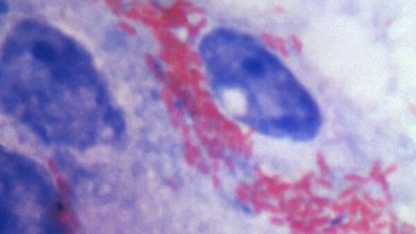 普罗瓦泽克立克次体（Rickettsia prowazekii）是流行性斑疹伤寒的病原体  - 俄罗斯卫星通讯社