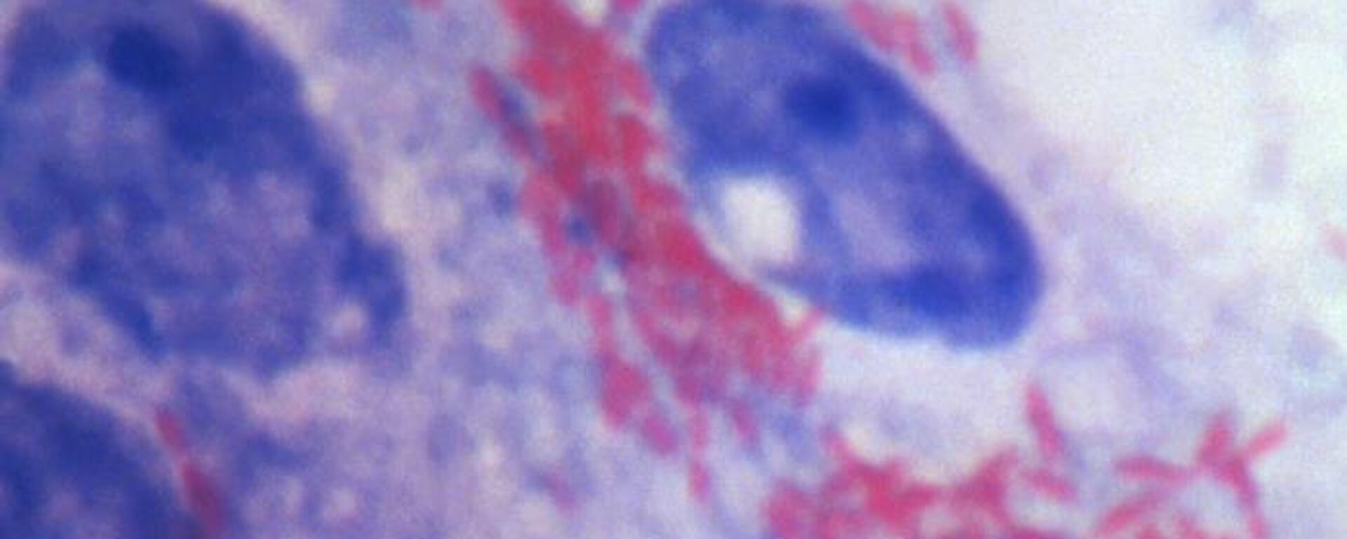 普罗瓦泽克立克次体（Rickettsia prowazekii）是流行性斑疹伤寒的病原体  - 俄罗斯卫星通讯社, 1920, 16.09.2026