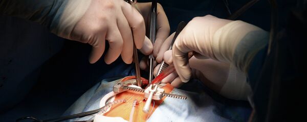 心脏外科手术 - 俄罗斯卫星通讯社