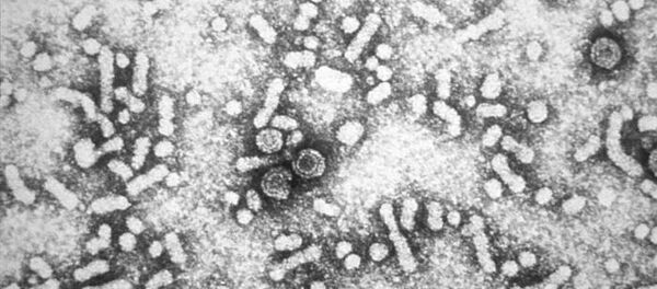 乙型肝炎病毒 - 俄羅斯衛星通訊社