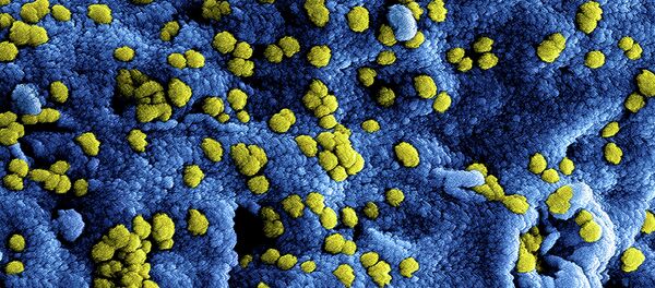 世卫组织建议韩国准备好应对MERS疫情扩散 限制出境 世卫组织建议韩国准备好应对MERS疫情扩散 限制出境 - 俄罗斯卫星通讯社