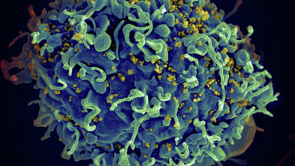 HIV，艾滋病病毒（黃色），感染人類細胞 - 俄羅斯衛星通訊社