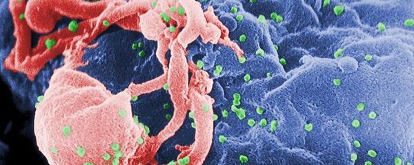 人类免疫缺陷病毒 - 俄罗斯卫星通讯社