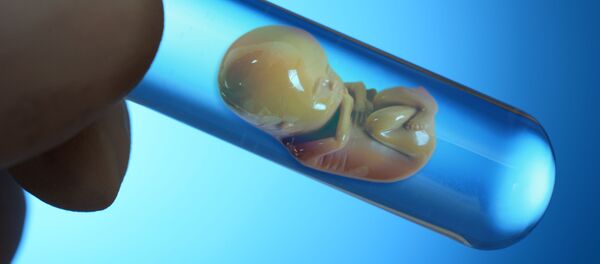 荷兰将允许为做研究而培育人类胚胎 - 俄罗斯卫星通讯社