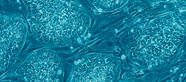 干细胞 - 俄罗斯卫星通讯社