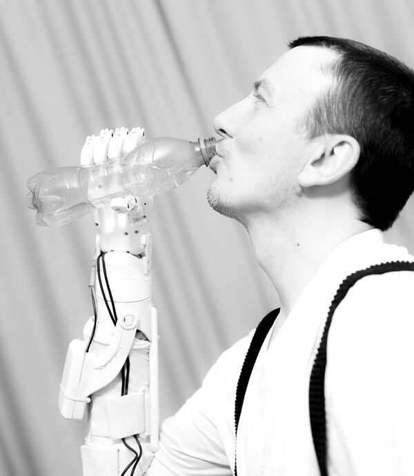 手臂假肢 手臂假肢 - 俄罗斯卫星通讯社