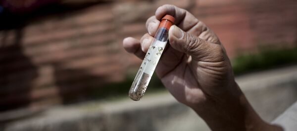 Личинки москитов, передающих вирус Зика, в пробирке - 俄罗斯卫星通讯社