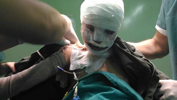 被烧伤的叙利亚女孩遭到更严重的媒体中伤 - 俄罗斯卫星通讯社