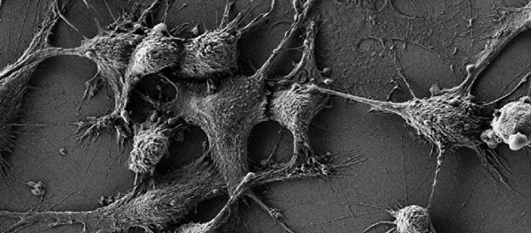 俄專家發現抗輻射納米粒子 - 俄羅斯衛星通訊社