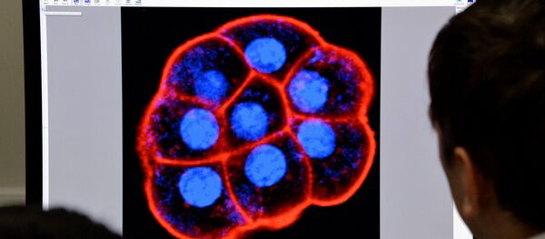 学者们找到一种能战胜老年痴呆症的药物 - 俄罗斯卫星通讯社