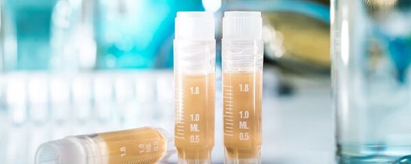 朝鲜爆发甲型H1N1流感病毒 - 俄罗斯卫星通讯社