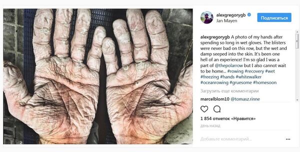 賽艇奧運冠軍曬出自己橫渡北冰洋12天後兩個手掌的照片 - 俄羅斯衛星通訊社
