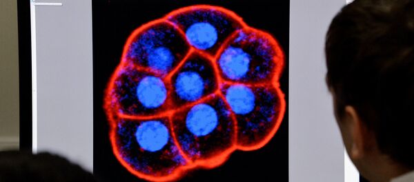Клетка под микроскопом - 俄羅斯衛星通訊社