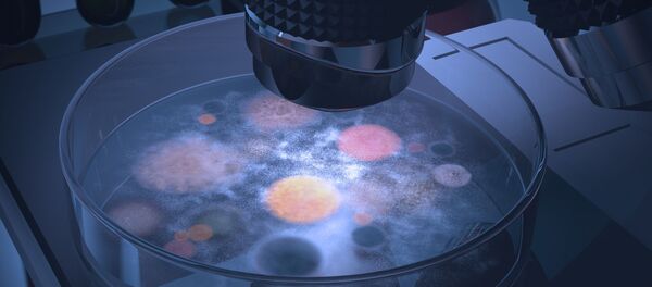 医生在一名美国男子头部发现致命真菌 - 俄罗斯卫星通讯社